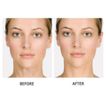 5 Pairs Instant Beauty Face Nutrition Wrinkle Removal Lift Sticker